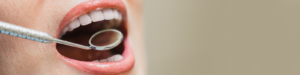 5 Tips for Stunning Teeth Whitening Results