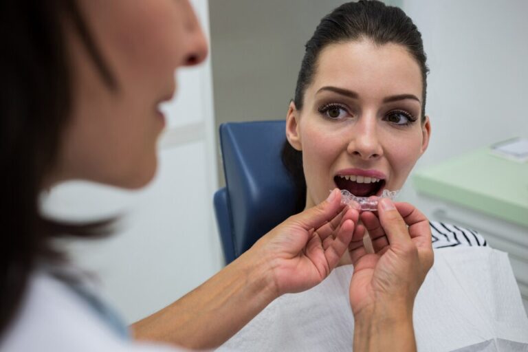 Invisalign Dentist Secrets for a Confident Smile