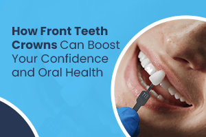 How Front Teeth Crowns Can Boost Your Confidence and Oral Health