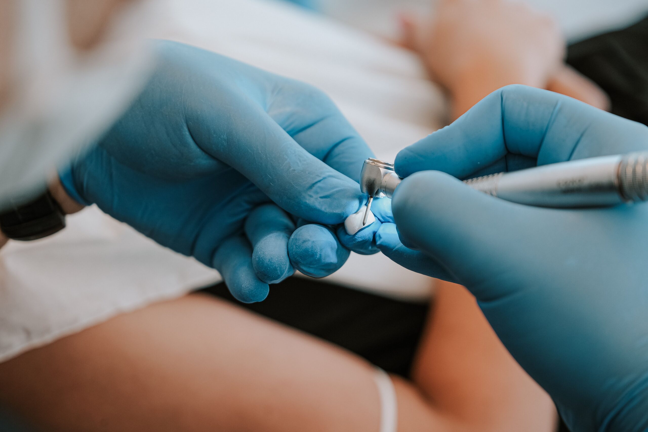 Affordable Dental Clinic in Brampton